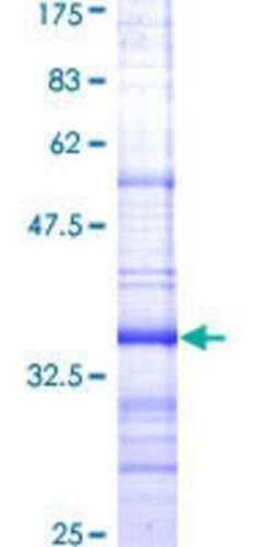 Novus Biologicals Recombinant Human NPY1R GST (N-Term) Protein 25 &mu;g | Buy Online | Novus Biologicals&trade; | Fisher Scientific