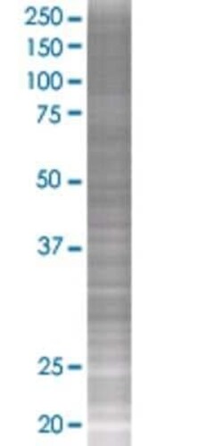 Novus Biologicals NPY5R 293T Cell Transient Overexpression Lysate 0.1 mL | Buy Online | Novus Biologicals&trade; | Fisher Scientific