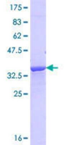 Novus Biologicals Recombinant Human NRAP GST (N-Term) Protein 10 &mu;g | Buy Online | Novus Biologicals&trade; | Fisher Scientific