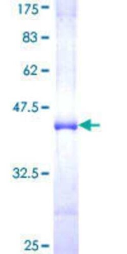 Novus Biologicals Recombinant Human NUP98 GST (N-Term) Protein 25 &mu;g | Buy Online | Novus Biologicals&trade; | Fisher Scientific