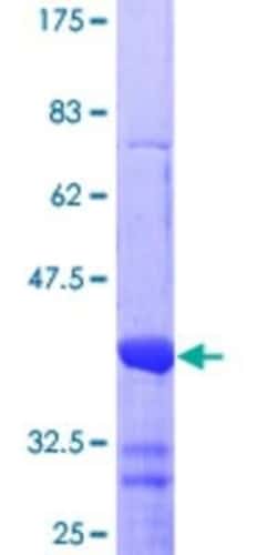 Novus Biologicals Recombinant Human Nurr1/NGFI-B beta/NR4A2 GST (N-Term) Protein 10 &mu;g | Buy Online | Novus Biologicals&trade; | Fisher Scientific