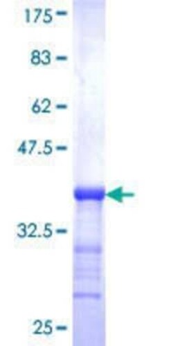 Novus Biologicals Recombinant Human NVL GST (N-Term) Protein 25 &mu;g | Buy Online | Novus Biologicals&trade; | Fisher Scientific