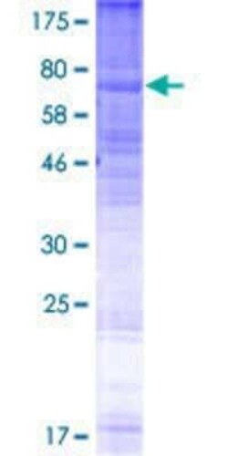 Novus Biologicals Recombinant Human OA1 GST (N-Term) Protein 2 &mu;g | Buy Online | Novus Biologicals&trade; | Fisher Scientific