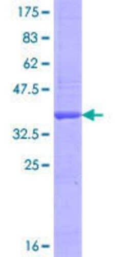 Novus Biologicals Recombinant Human OATL1 GST (N-Term) Protein 10 &mu;g | Buy Online | Novus Biologicals&trade; | Fisher Scientific