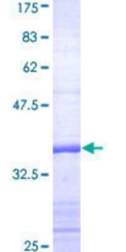 Novus Biologicals Recombinant Human OCA2 GST (N-Term) Protein 10 &mu;g | Buy Online | Novus Biologicals&trade; | Fisher Scientific
