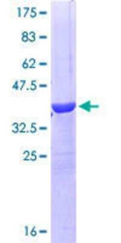 Novus Biologicals Recombinant Human Occludin GST (N-Term) Protein 10 &mu;g | Buy Online | Novus Biologicals&trade; | Fisher Scientific