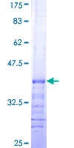 Novus Biologicals Recombinant Human OCRL GST (N-Term) Protein 25 &mu;g | Buy Online | Novus Biologicals&trade; | Fisher Scientific