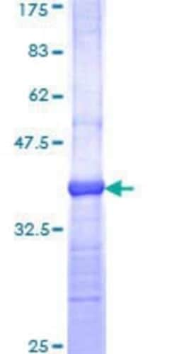 Novus Biologicals Recombinant Human OPA1 GST (N-Term) Protein 10 &mu;g | Buy Online | Novus Biologicals&trade; | Fisher Scientific