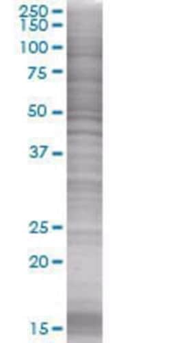 Novus Biologicals&trade;&nbsp;Osteoprotegerin/TNFRSF11B 293T Cell Transient Overexpression Lysate