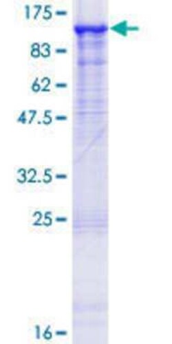 Novus Biologicals Recombinant Human OPHN1 GST (N-Term) Protein 10 &mu;g | Buy Online | Novus Biologicals&trade; | Fisher Scientific