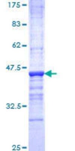 Novus Biologicals Recombinant Human OPHN1 GST (N-Term) Protein 25 &mu;g | Buy Online | Novus Biologicals&trade; | Fisher Scientific