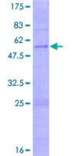 Novus Biologicals Recombinant Human OR3A2 GST (N-Term) Protein 2 &mu;g | Buy Online | Novus Biologicals&trade; | Fisher Scientific