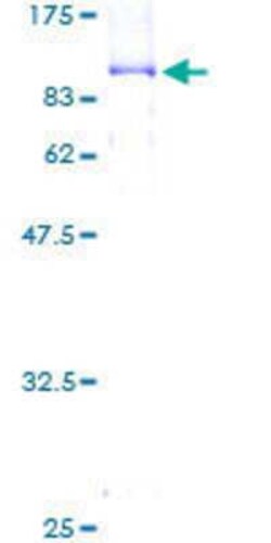 Novus Biologicals Recombinant Human Orc2 GST (N-Term) Protein 10 &mu;g | Buy Online | Novus Biologicals&trade; | Fisher Scientific