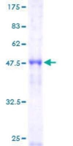Novus Biologicals Recombinant Human ORC4L GST (N-Term) Protein 25 &mu;g | Buy Online | Novus Biologicals&trade; | Fisher Scientific