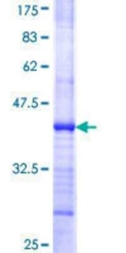 Novus Biologicals Recombinant Human ORC5L GST (N-Term) Protein 2 &mu;g | Buy Online | Novus Biologicals&trade; | Fisher Scientific