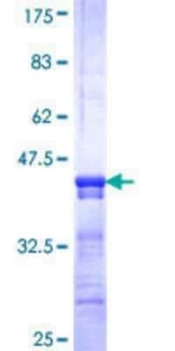 Novus Biologicals Recombinant Human solute carrier family 22, member 18 antisense GST (N-Term) Protein 10 &mu;g | Buy Online | Novus Biologicals&trade; | Fisher Scientific