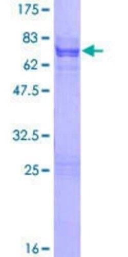 Novus Biologicals Recombinant Human Otx1 GST (N-Term) Protein 2 &mu;g | Buy Online | Novus Biologicals&trade; | Fisher Scientific