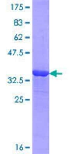 Novus Biologicals Recombinant Human OVGP1 GST (N-Term) Protein 25 &mu;g | Buy Online | Novus Biologicals&trade; | Fisher Scientific