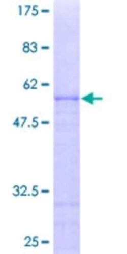 Novus Biologicals Recombinant Human OVOL1 GST (N-Term) Protein 25 &mu;g | Buy Online | Novus Biologicals&trade; | Fisher Scientific