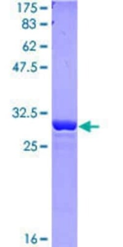 Novus Biologicals Recombinant Human OXCT1 GST (N-Term) Protein 10 &mu;g | Buy Online | Novus Biologicals&trade; | Fisher Scientific
