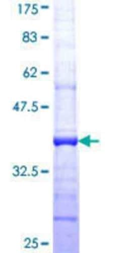 Novus Biologicals Recombinant Human P2X3/P2RX3 GST (N-Term) Protein 25 &mu;g | Buy Online | Novus Biologicals&trade; | Fisher Scientific