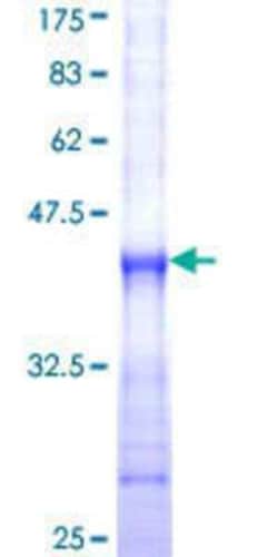 Novus Biologicals Recombinant Human P2X5/P2RX5 GST (N-Term) Protein 25 &mu;g | Buy Online | Novus Biologicals&trade; | Fisher Scientific