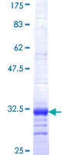 Novus Biologicals Recombinant Human P2Y1/P2RY1 GST (N-Term) Protein 10 &mu;g | Buy Online | Novus Biologicals&trade; | Fisher Scientific