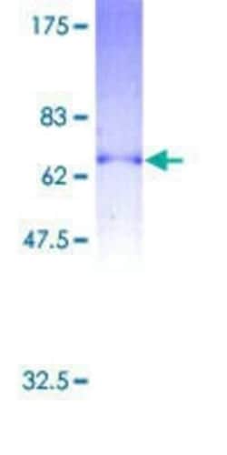 Novus Biologicals Recombinant Human P2Y2 GST (N-Term) Protein 2 &mu;g | Buy Online | Novus Biologicals&trade; | Fisher Scientific