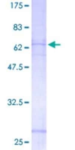 Novus Biologicals Recombinant Human P2Y11/P2RY11 GST (N-Term) Protein 2 &mu;g | Buy Online | Novus Biologicals&trade; | Fisher Scientific