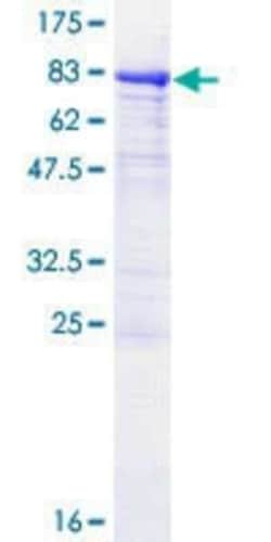 Novus Biologicals Recombinant Human P4HA1 GST (N-Term) Protein 10 &mu;g | Buy Online | Novus Biologicals&trade; | Fisher Scientific