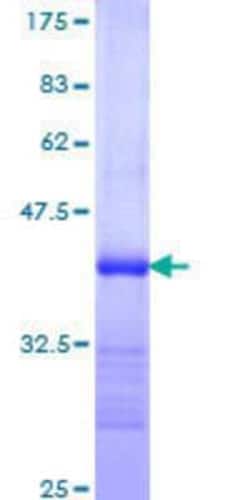 Novus Biologicals&trade;&nbsp;Recombinant Human PACE4/PCSK6 GST (N-Term) Protein