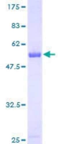 Novus Biologicals Recombinant Human PAFAH1B2 GST (N-Term) Protein 25 &mu;g | Buy Online | Novus Biologicals&trade; | Fisher Scientific