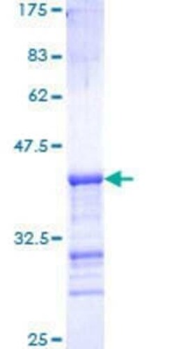 Novus Biologicals Recombinant Human PAK1 GST (N-Term) Protein 10 &mu;g | Buy Online | Novus Biologicals&trade; | Fisher Scientific
