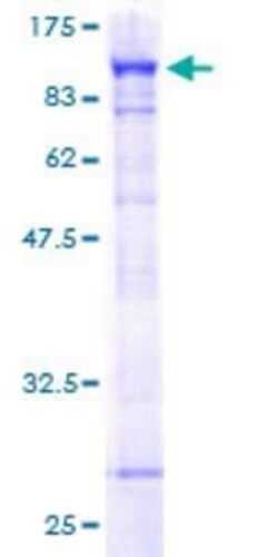 Novus Biologicals Recombinant Human PARN GST (N-Term) Protein 2 &mu;g | Buy Online | Novus Biologicals&trade; | Fisher Scientific
