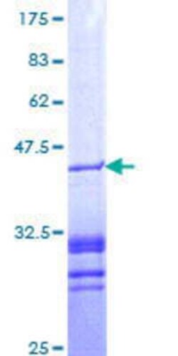 Novus Biologicals Recombinant Human PAWR/ PAR4 GST (N-Term) Protein 25 &mu;g | Buy Online | Novus Biologicals&trade; | Fisher Scientific
