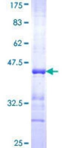Novus Biologicals Recombinant Human Pax2 GST (N-Term) Protein 10 &mu;g | Buy Online | Novus Biologicals&trade; | Fisher Scientific