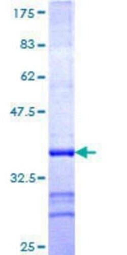 Novus Biologicals Recombinant Human Pax3 GST (N-Term) Protein 10 &mu;g | Buy Online | Novus Biologicals&trade; | Fisher Scientific