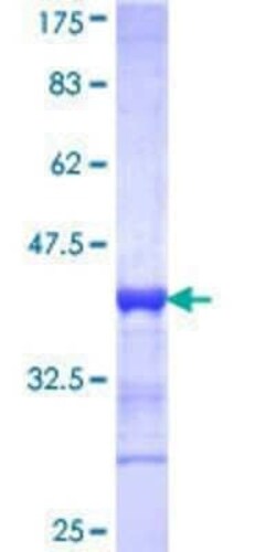 Novus Biologicals Recombinant Human Pax4 GST (N-Term) Protein 10 &mu;g | Buy Online | Novus Biologicals&trade; | Fisher Scientific