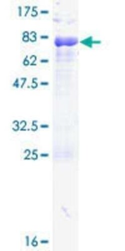 Novus Biologicals Recombinant Human Pax6 GST (N-Term) Protein 25 &mu;g | Buy Online | Novus Biologicals&trade; | Fisher Scientific