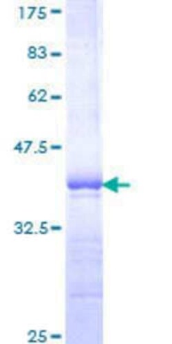 Novus Biologicals&trade;&nbsp;Recombinant Human PBX1 GST (N-Term) Protein