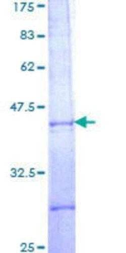 Novus Biologicals Recombinant Human PBX2 GST (N-Term) Protein 10 &mu;g | Buy Online | Novus Biologicals&trade; | Fisher Scientific