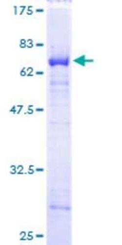 Novus Biologicals Recombinant Human PCBP2 GST (N-Term) Protein 25 &mu;g | Buy Online | Novus Biologicals&trade; | Fisher Scientific