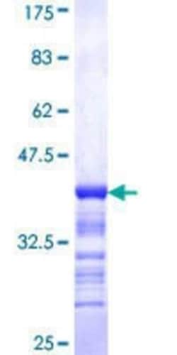 Novus Biologicals Recombinant Human PCBP2 GST (N-Term) Protein 25 &mu;g | Buy Online | Novus Biologicals&trade; | Fisher Scientific