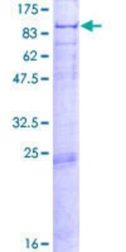 Novus Biologicals Recombinant Human PCCA GST (N-Term) Protein 2 &mu;g | Buy Online | Novus Biologicals&trade; | Fisher Scientific