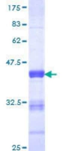 Novus Biologicals Recombinant Human Protocadherin-1 GST (N-Term) Protein 10 &mu;g | Buy Online | Novus Biologicals&trade; | Fisher Scientific