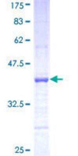 Novus Biologicals Recombinant Human Protocadherin-8 GST (N-Term) Protein 25 &mu;g | Buy Online | Novus Biologicals&trade; | Fisher Scientific