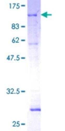 Novus Biologicals Recombinant Human PCK2 GST (N-Term) Protein 10 &mu;g | Buy Online | Novus Biologicals&trade; | Fisher Scientific