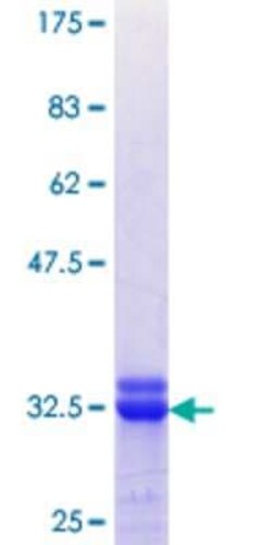 Novus Biologicals Recombinant Human PCP4 GST (N-Term) Protein 25 &mu;g | Buy Online | Novus Biologicals&trade; | Fisher Scientific