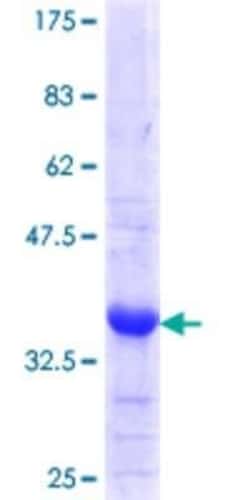 Novus Biologicals Recombinant Human PC6 GST (N-Term) Protein 25 &mu;g | Buy Online | Novus Biologicals&trade; | Fisher Scientific