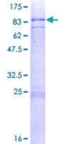 Novus Biologicals Recombinant Human PCTAIRE2 GST (N-Term) Protein 2 &mu;g | Buy Online | Novus Biologicals&trade; | Fisher Scientific
